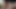 Micro Penis grows large from 0 cm to 20 cm