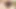 Estim Orgasmus mit Katheter