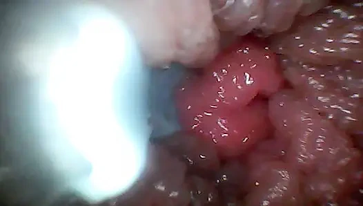 Aşırı yakınlık izleyiciyi aktif, aç bir katılımcıya dönüştürüyor