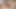 O Damn - Extremely Stretched Pussy and Big Gaping