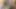 Gesichtsspritze