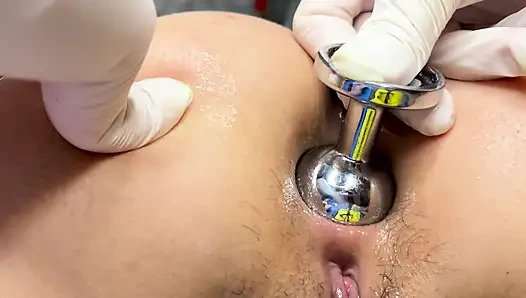 Memperbesar anus istriku menjadi 4cm