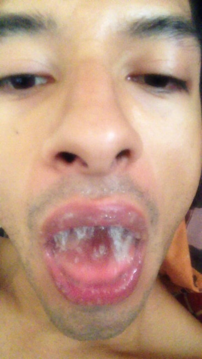 Swallowing straight loads