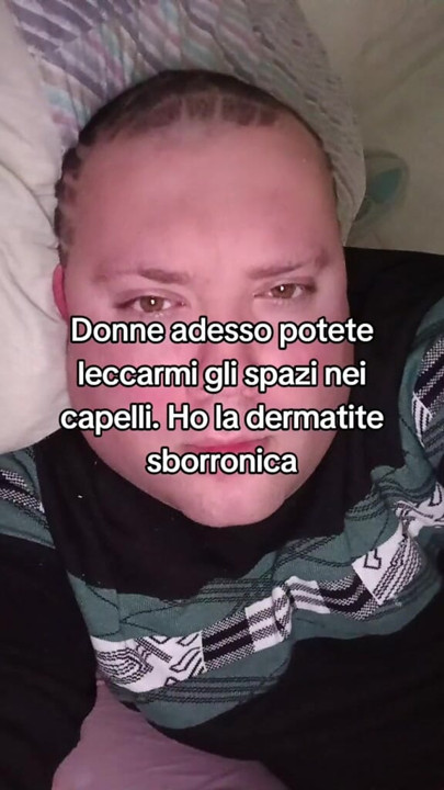 The tik tok master suffers from dermatitis