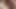 Amateur DP