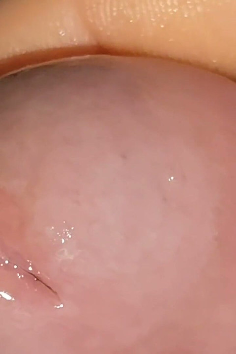 Urethral Fluid in Large Quantities Makes It Slippery.
