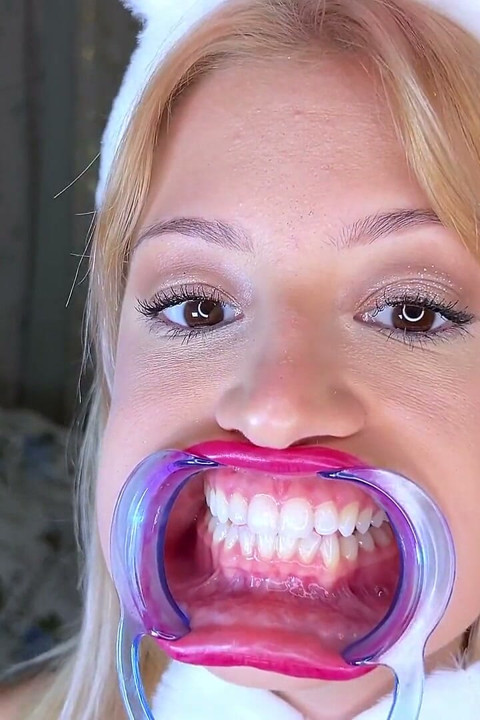 فحص أسنان ضام الفم