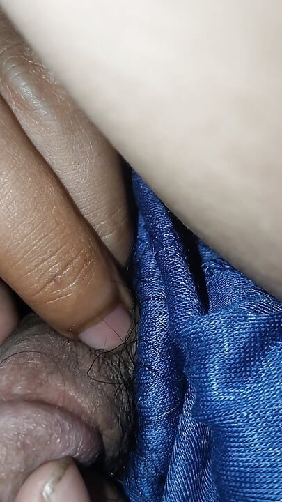 Acne on my penis I want to clean it up