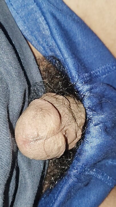 Acne on my penis I want to clean it up