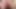 I had an orgasm in a masturbator after anal masturbation