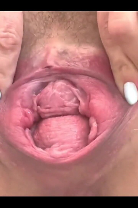 My First Video with Speculum