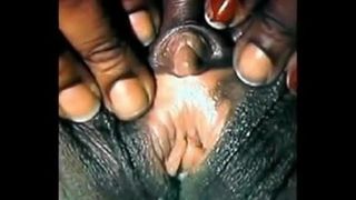 Il clitoride