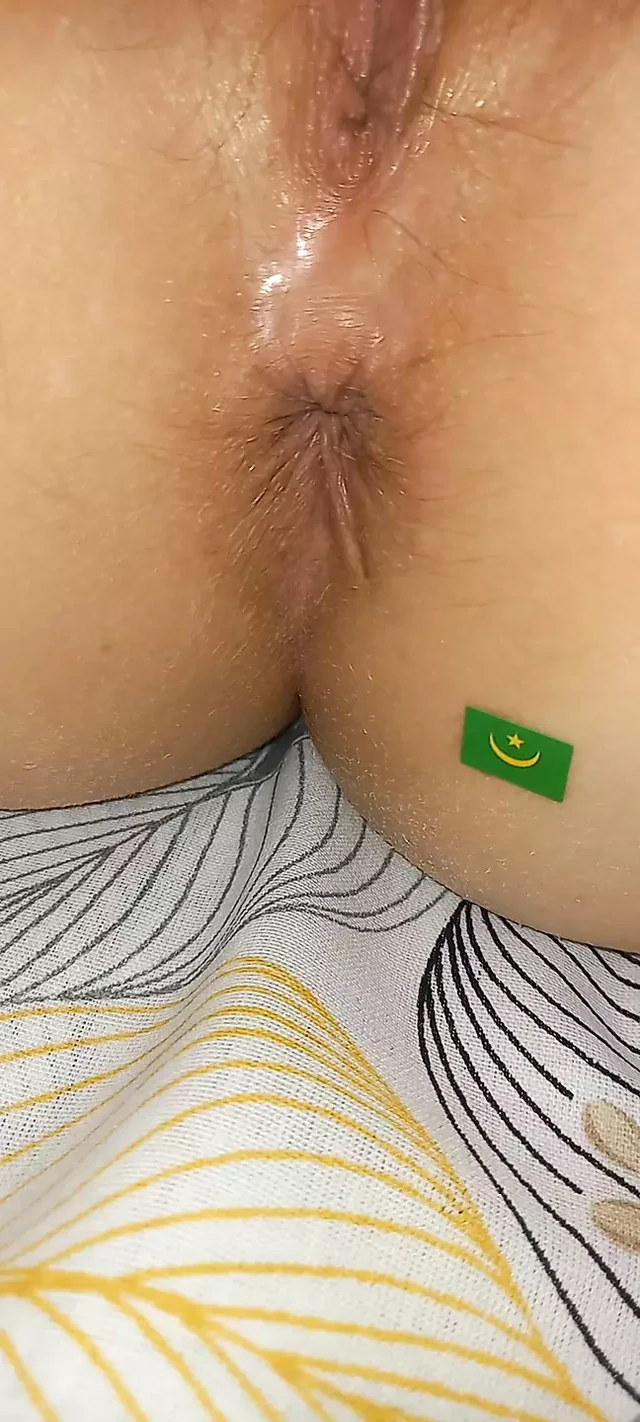 Noukchott anus