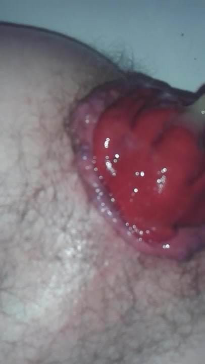 after fisting ass