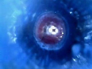 Einführkamera Endoskop tige Stamm Schwanz Ejac Sperma nach innen