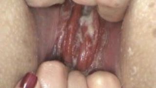Bat anaal neuken gapend en verzakking