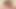 Drncm klasik lezbiyen c20