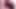 STRETCHED OPEN PUSSY WALLS COMPILATION