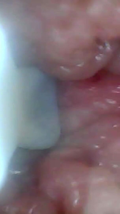Stunning moment from "Endoscope camera shows the most sensitive parts of the penis Educational video"