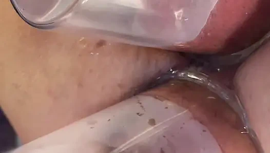 Экстремальная двойная вакуумная накачка задницы и киски крупным планом