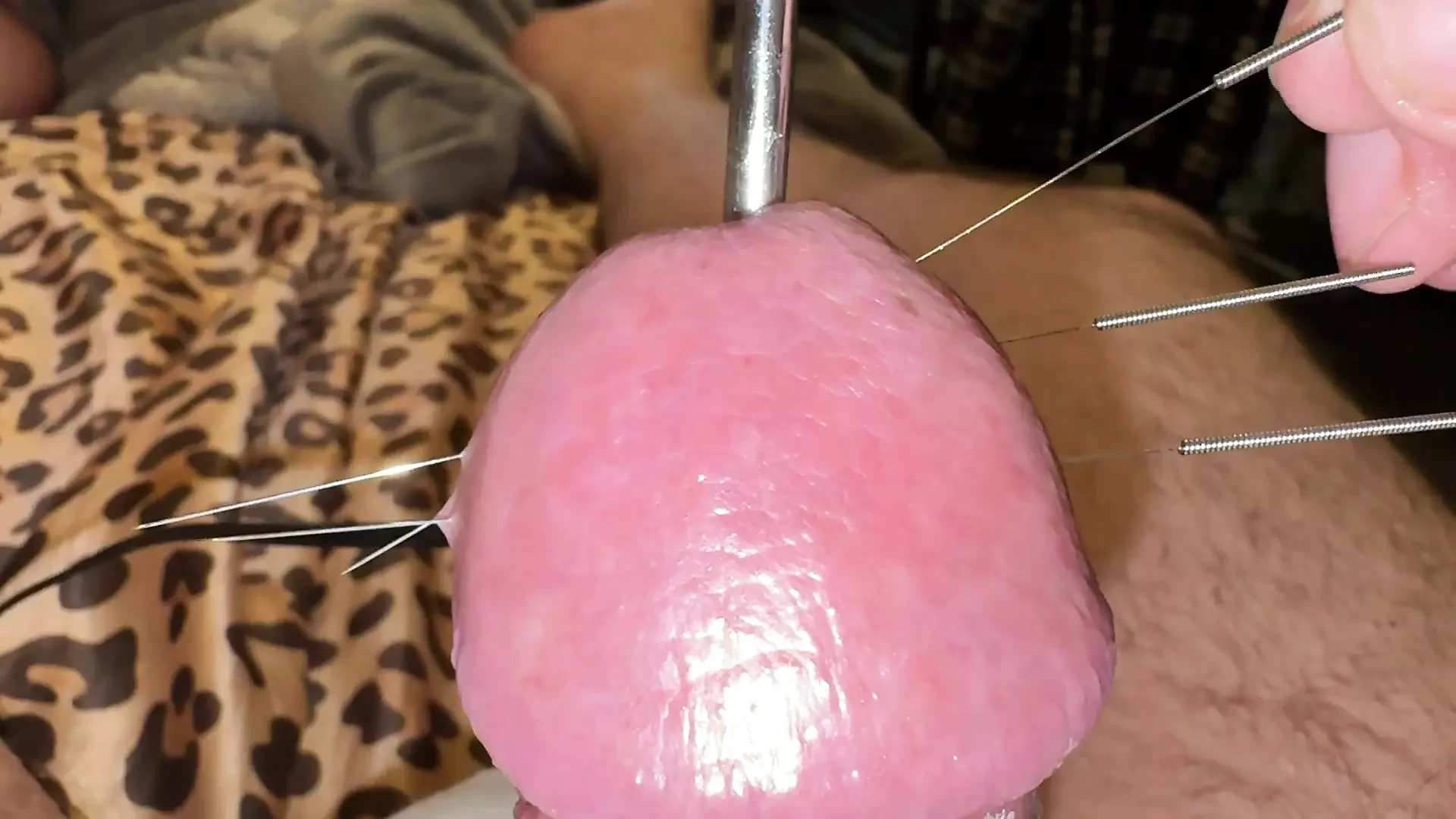 Needles through the hard glans!