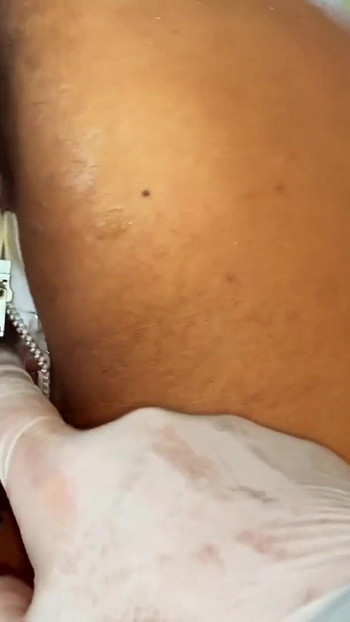 Pregled videozapisa