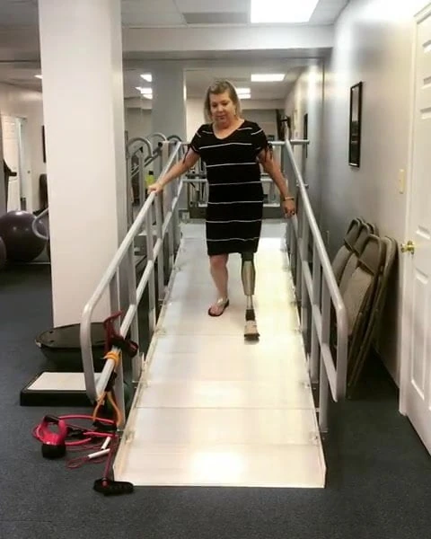 pretty hip amputee