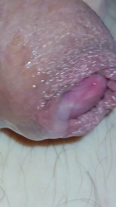 Phimosis close up cum