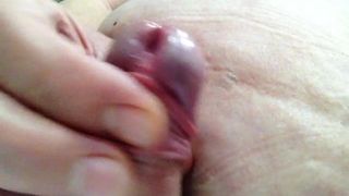 Сперма после обрезания в течение пяти дней