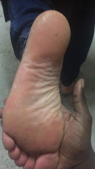 Apartment neighbor dry feet 3