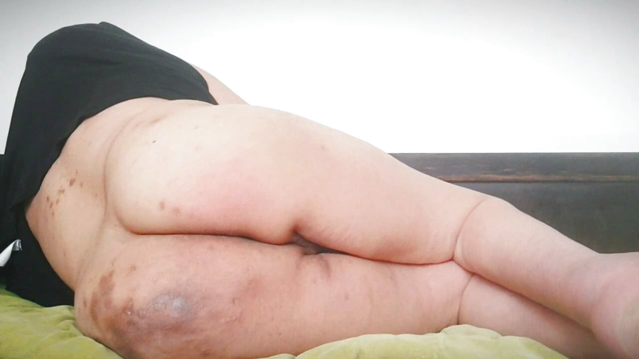 Niepełnosprawny mężczyzna w upale pokazuje swoje grube świnki pośladki