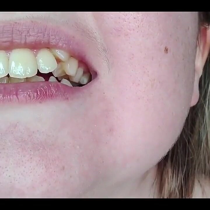 My Mouth, Teeth, Tongue and Throat up Close