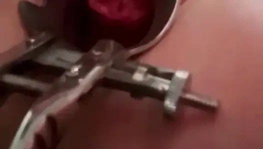 Я и мое гинекологическое зеркало