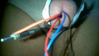 Harte Schätzung mit Harnröhren-Elektroden