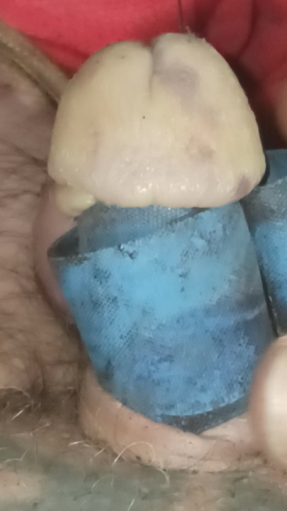 Minik sabitlenmiş penis