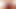 Suction cup anal plug
