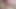 Hair Fetishist Boy Cheats on His Girlfriend in Front of Her with a Girl with a Hairy Pussy and Armpits