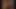 Tania Lariviere La Doctoresse A des Gros Seins 2 (1992)