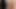I Showed My Penis To My Best Friend - Her Honest Reaction