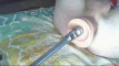 Pregled videozapisa