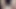 Saline Balls Teaser