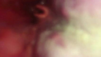 trachea my girlfriend