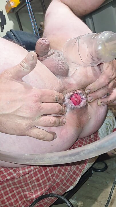 Training prolapse