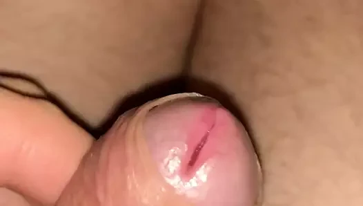 Dig