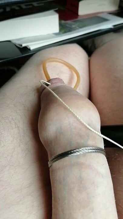 E-stim