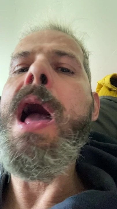 NOSE SNOT AND SPIT ON MY BEARD