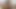 Lizzy Yum December 2023 locked up AGAIN Post Op Orgasm Pussy masturbation teasing