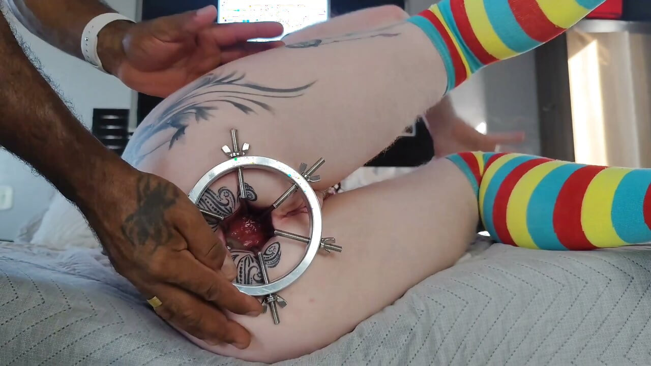 ANAL DILATION MAKES MY ASS FOLDS BURST