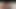 ARSCHHAAR VON EHEFRAU SAUBER! XXX VIDEO! XNXX VIDEO! HEIßE WEB-SERIE