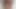 Lizzy Yum december 2023 Anal exhaustive #1 Post Op Orgasm Pussy Anal masturbation teasing